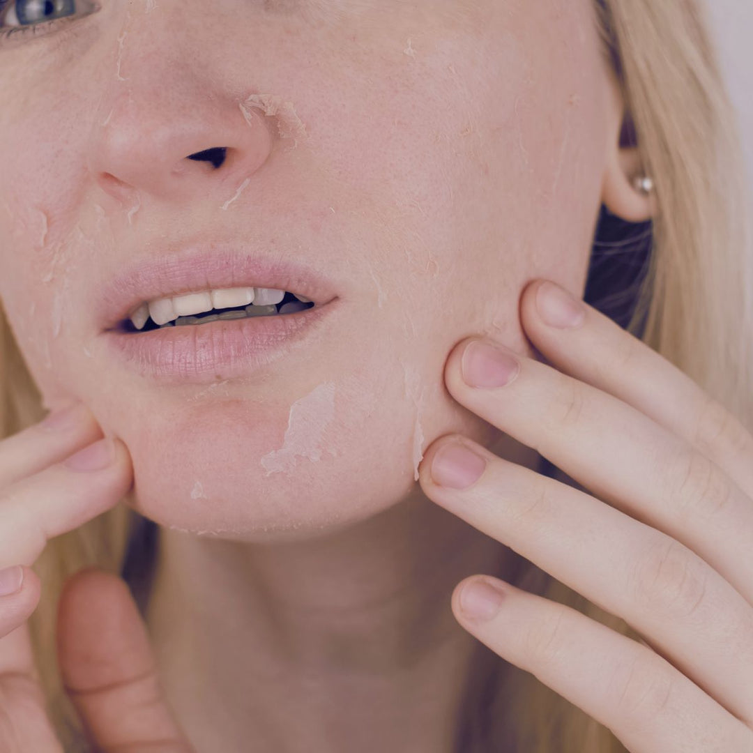 dryness-and-dehydration-thumbnail-soul-apothecary